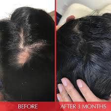 قرص تقویت کننده مو هیرتامین (Hairtamin Advanced)