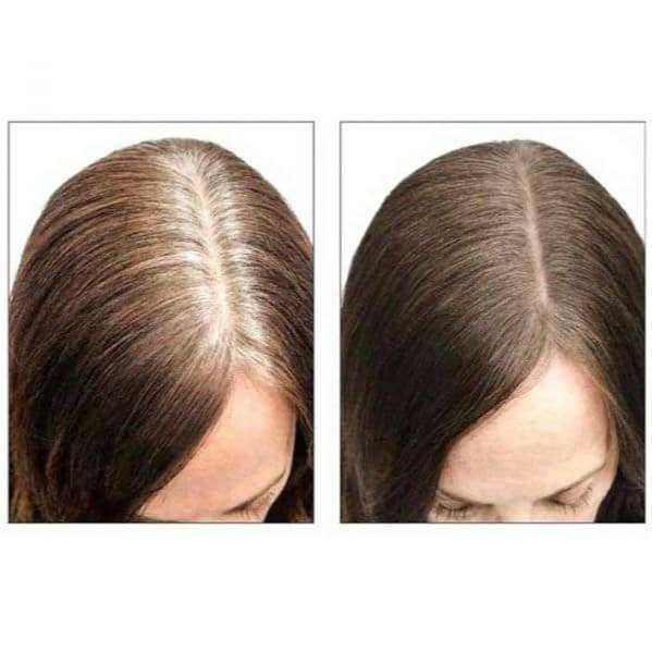 استیک پوشاننده مو سفید گلدنرز